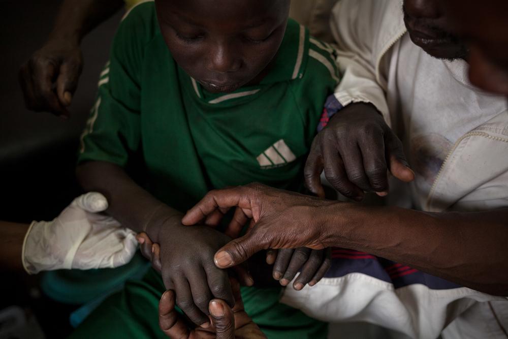 Combatting neglected tropical diseases 
