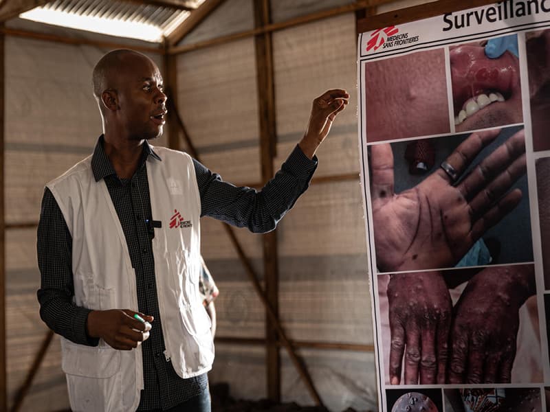 A man wears an MSF vest over a blue shirt and points to enlarged photos of clinical images